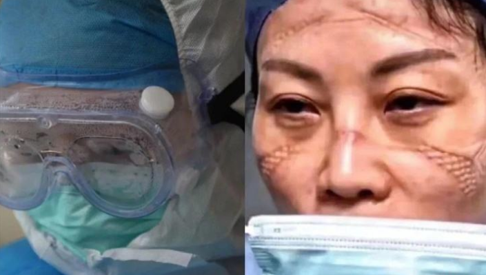 ��䓳���Է�������ߡ�ǰ�����_����